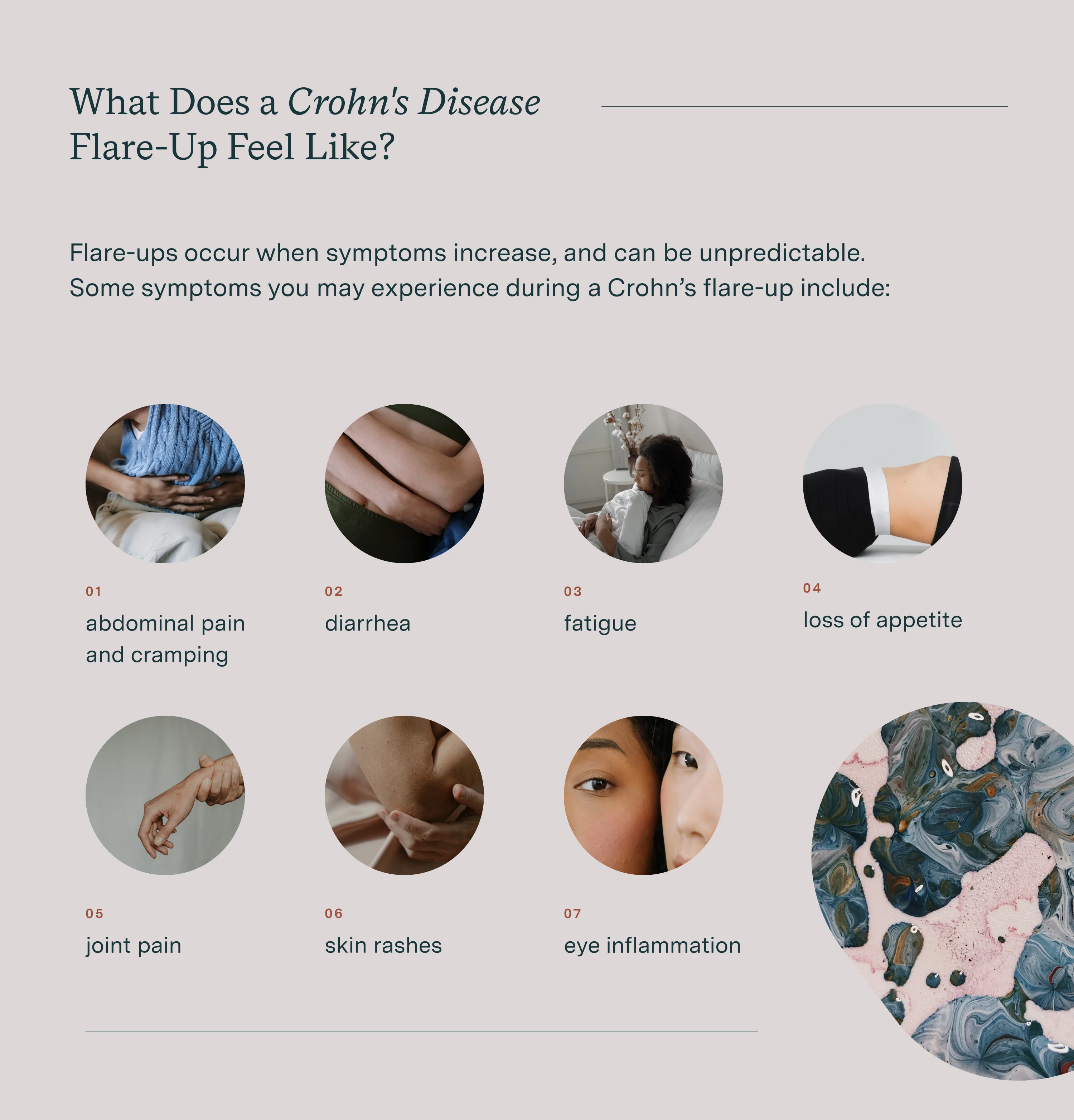 what does a crohn's disease flare-up feel like